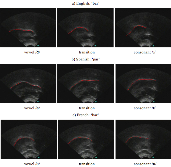 9 panes of ultrasound images of the mandible